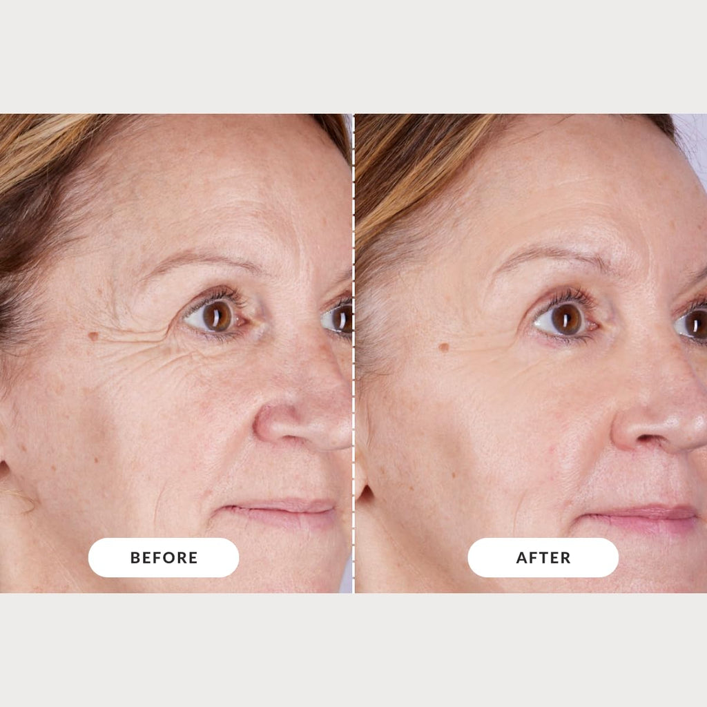 CurrentBody Skin LED Light Therapy Mask: Series 2 CurrentBody