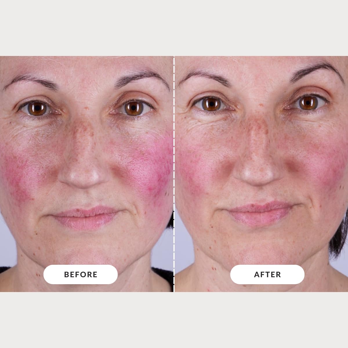CurrentBody Skin LED Light Therapy Mask: Series 2 CurrentBody