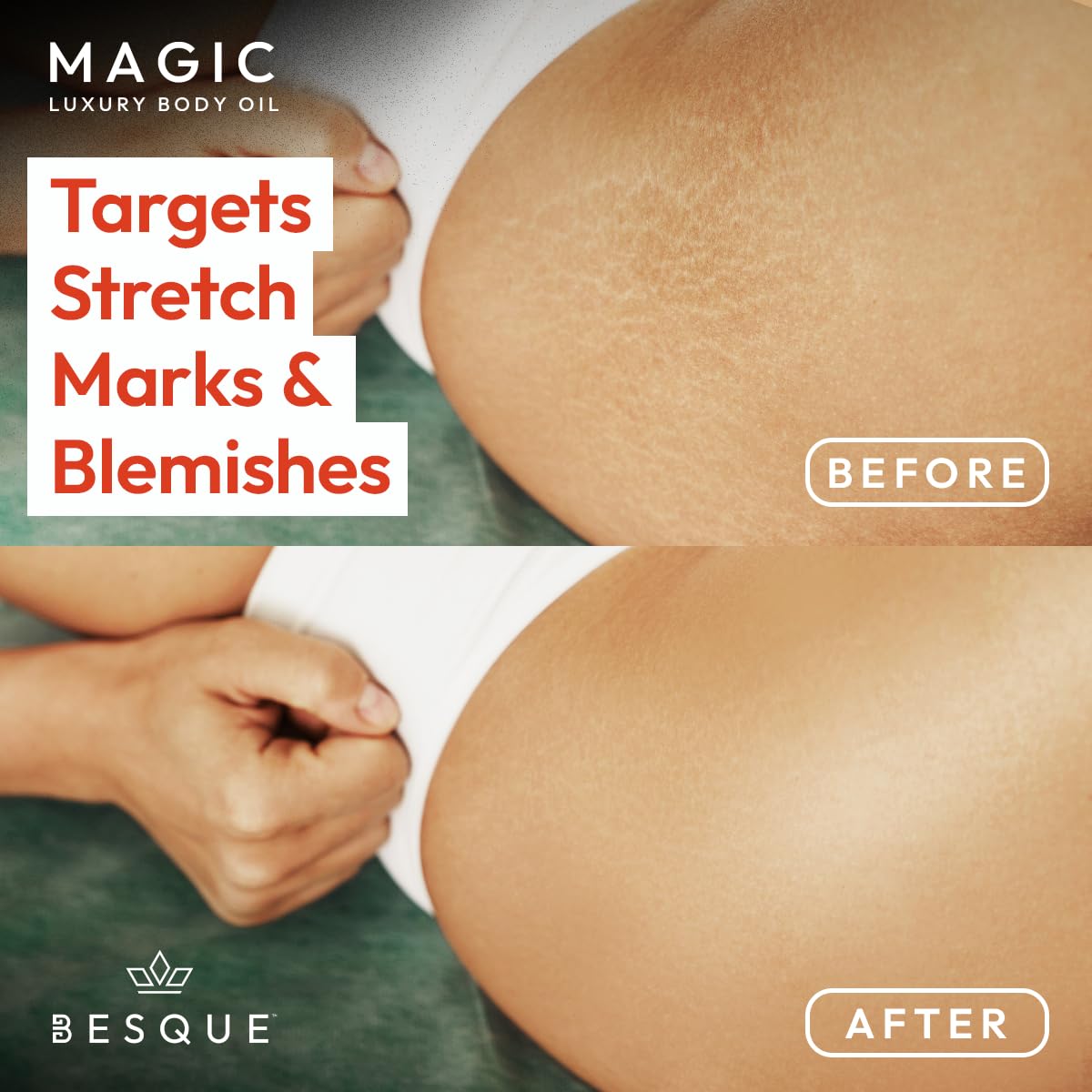 Besque Original Magic Body Oil, 3.4 FL OZ, After Shower Body Oil For Women, Hydrating Skin Care For Full Body That Plumps, Tightens, & Firms Skin With Natural Ingredients, Made In UK - Pack of 1 Besque