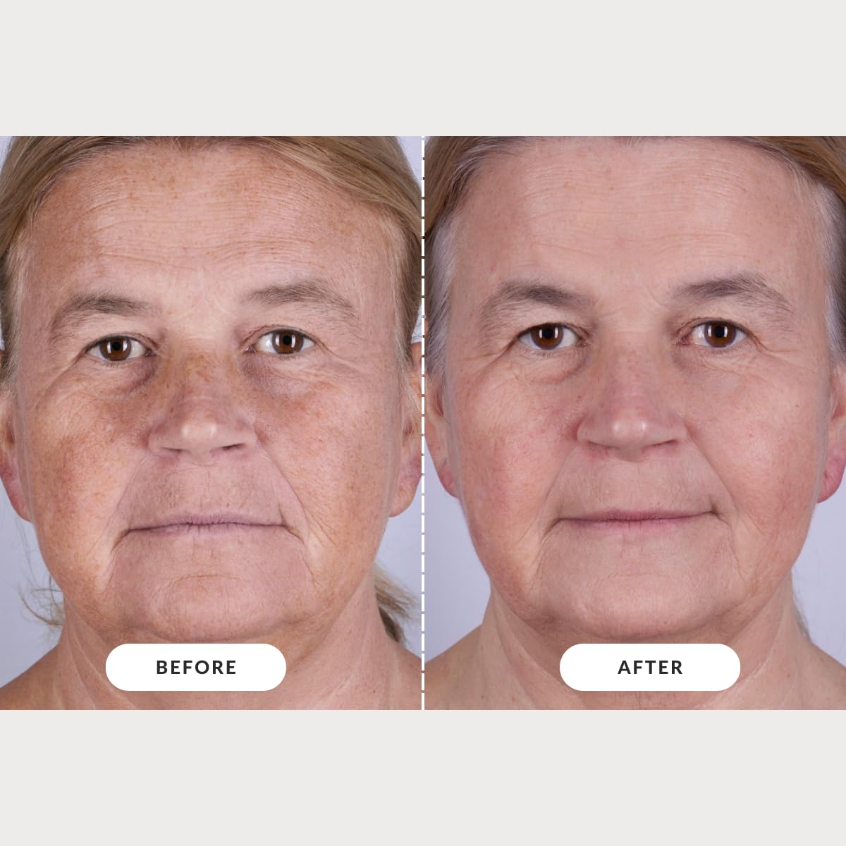 CurrentBody Skin LED Light Therapy Mask: Series 2 CurrentBody