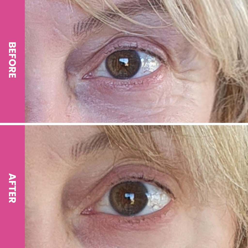 PRIME PROMETICS PrimeEyes Hydrate Under Eye Cream for Mature Women – Hydrating Eye Cream for Dark Circles and Wrinkle Repair – Soft, Glowing & Healthy Under Eyes PRIME PROMETICS