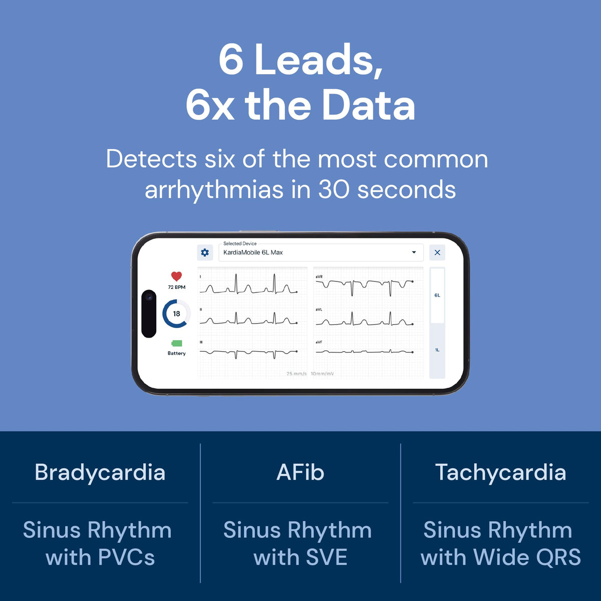 KardiaMobile 6L Max EKG Monitor, Includes One-Year KardiaCare Membership, FDA-Cleared Heart Monitor, Medical-Grade Results in 30 Seconds, Unlimited Recordings, Works with Smartphones and Tablets AliveCor