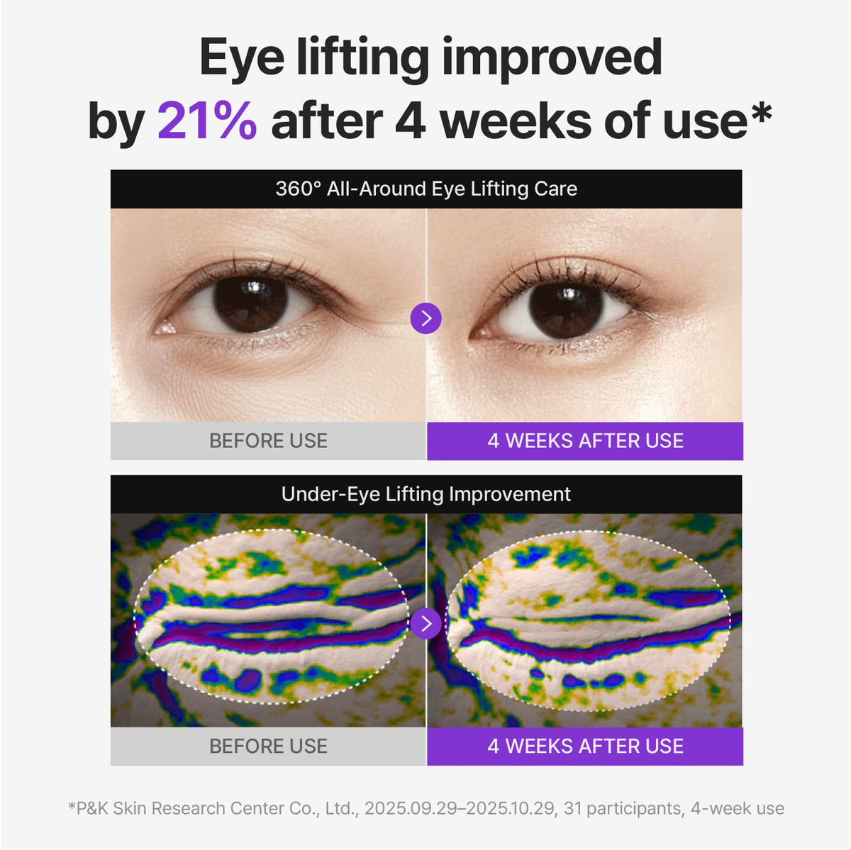 CENTELLIAN 24 360º Shot PDRN Eye Cream - Anti-Aging Retinol Eye Cream with TECA, Collagen, Firming & Wrinkle Smoothing, Hydrating Care for Dark Circles, Under-Eye Bags & Crow's Feet, 1.01 fl oz CENTELLIAN 24