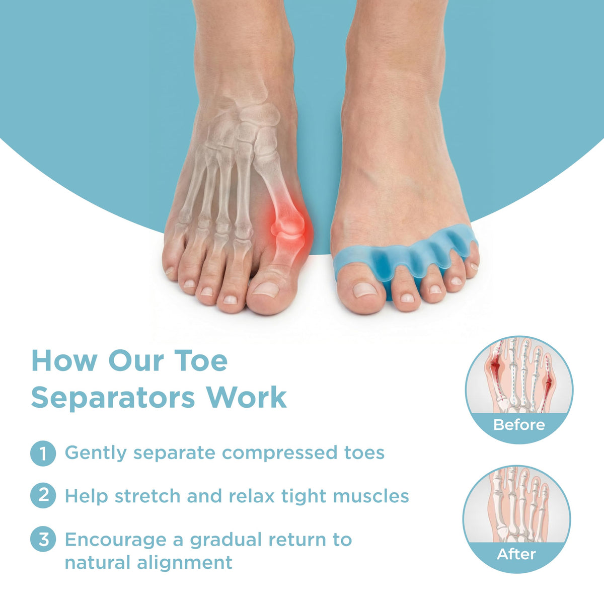 Mind Bodhi Toe Separators/Toe Spacers - For Men and Women - Regular Size – Black MIND BODHI HEALTH & WELLNESS