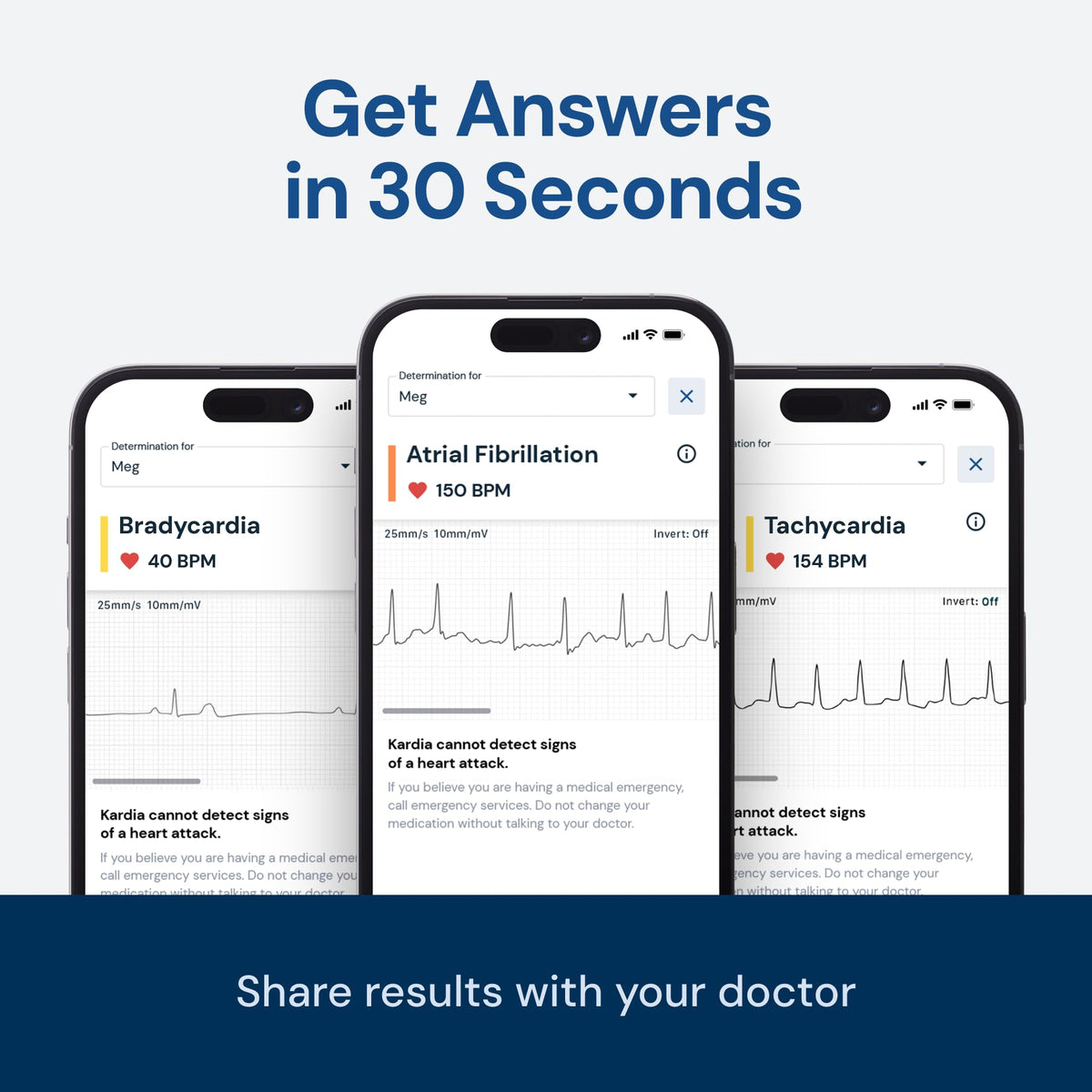 KardiaMobile 1-Lead EKG Monitor, Medical-Grade FDA-Cleared Personal Heart Monitor, Detects Normal, AFib & Arrhythmias, 30 Second Results, Works with Most Smartphones, HSA&FSA Eligible KARDIAMOBILE