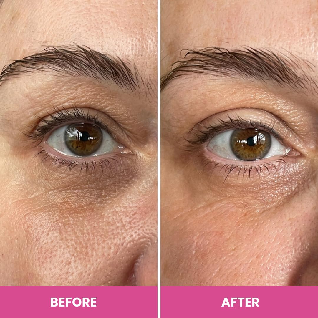PRIME PROMETICS PrimeEyes Hydrate Under Eye Cream for Mature Women – Hydrating Eye Cream for Dark Circles and Wrinkle Repair – Soft, Glowing & Healthy Under Eyes PRIME PROMETICS