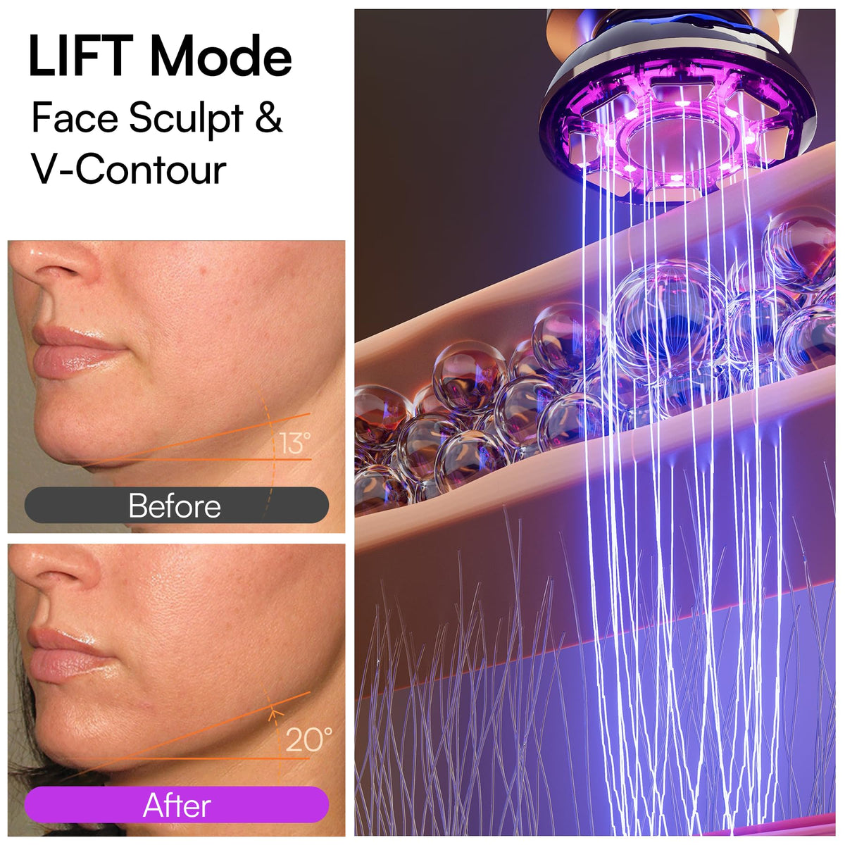 INIA Flare 3-in-1 Red Light Therapy Beauty Device for Face & Neck White INIA