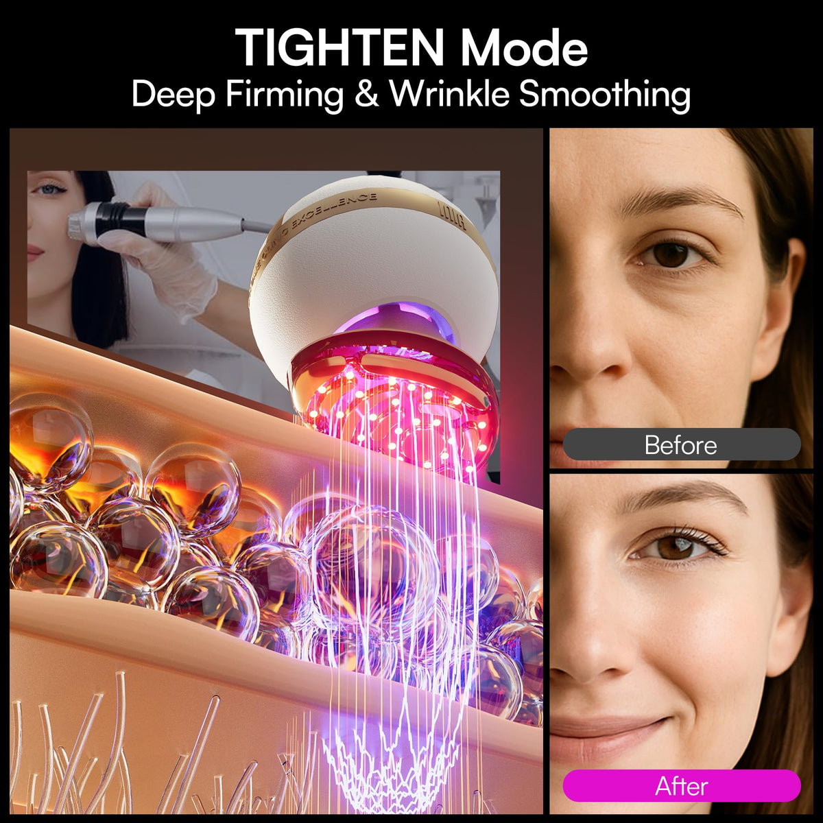 INIA SPHERA Upgraded 8-in-1 Microcurrent Facial Device for Face & Neck INIA