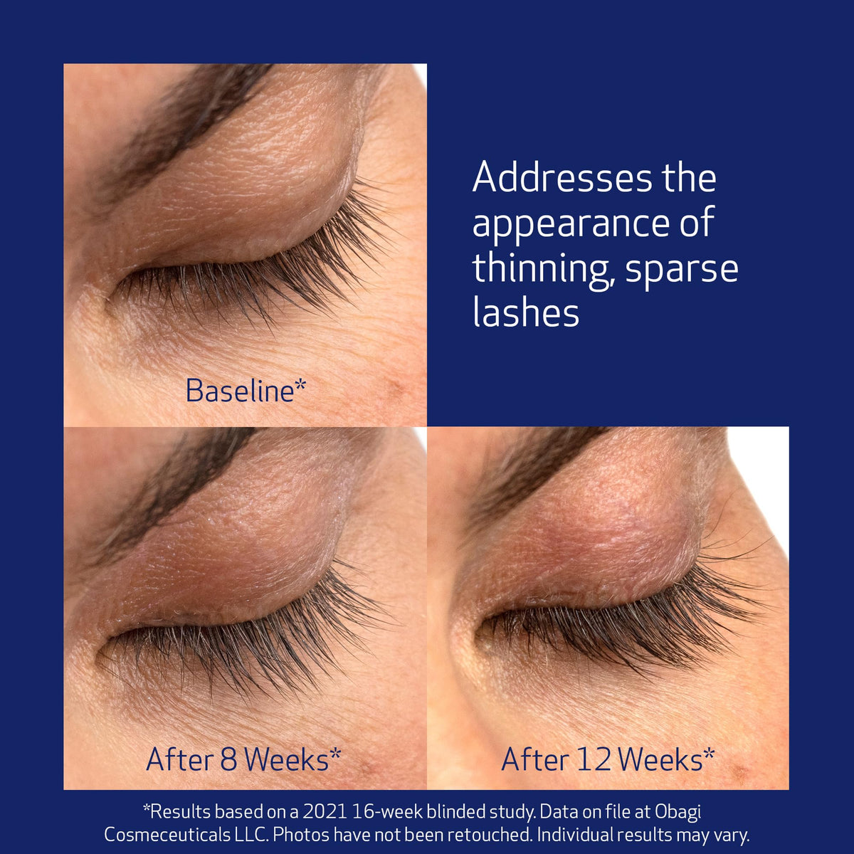 Obagi Nu-Cil Eyelash Enhancing Serum – Nourishing Lash Serum with Biotin for Thicker & More Defined-Looking Lashes – 0.1 oz Obagi Medical