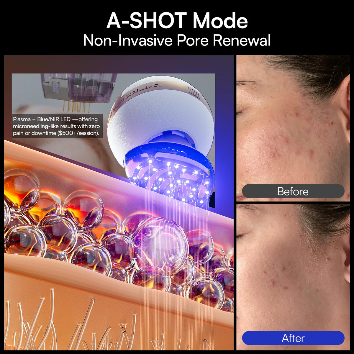 INIA SPHERA Upgraded 8-in-1 Microcurrent Facial Device for Face & Neck INIA