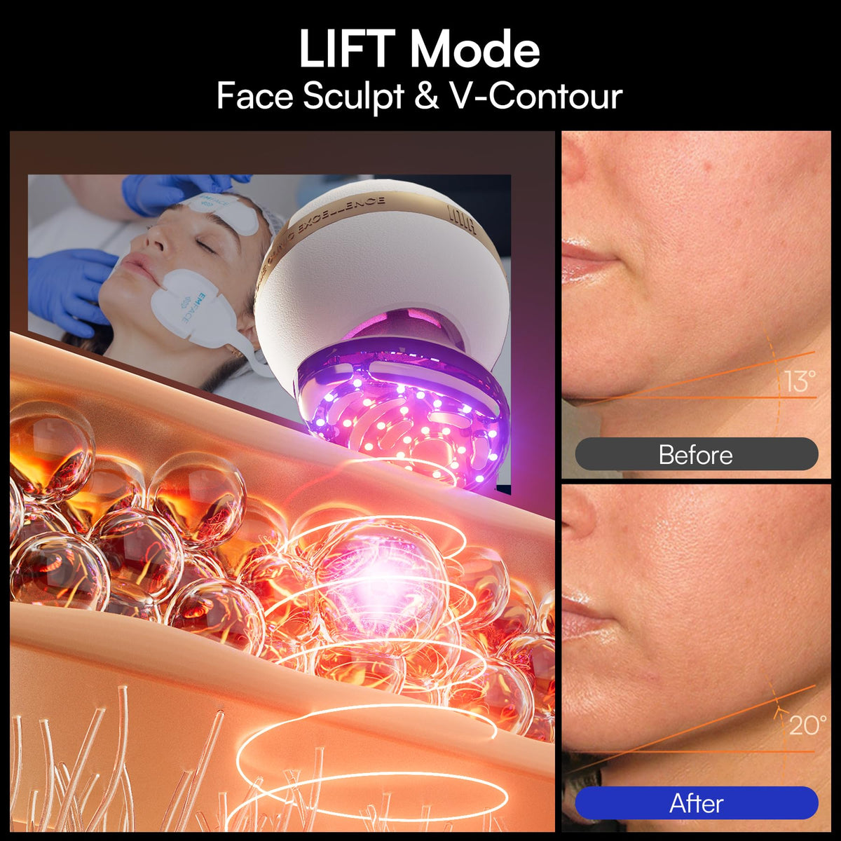 INIA SPHERA Upgraded 8-in-1 Microcurrent Facial Device for Face & Neck INIA